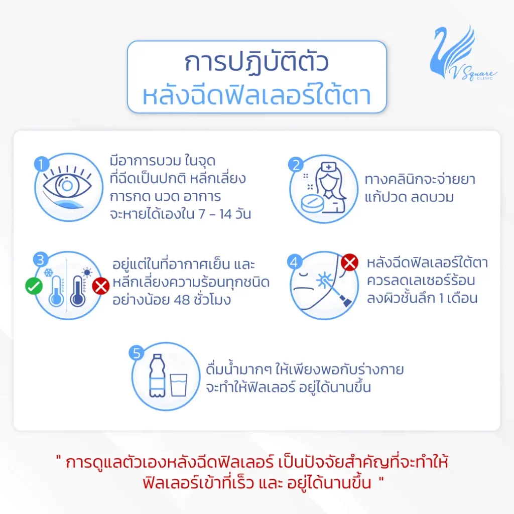 ข้อควรปฏิบัติหลังฉีดฟิลเลอร์ใต้ตา