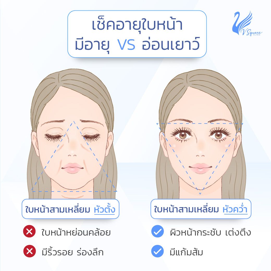 ฟิลเลอร์ยกหน้า เหมาะกับใคร