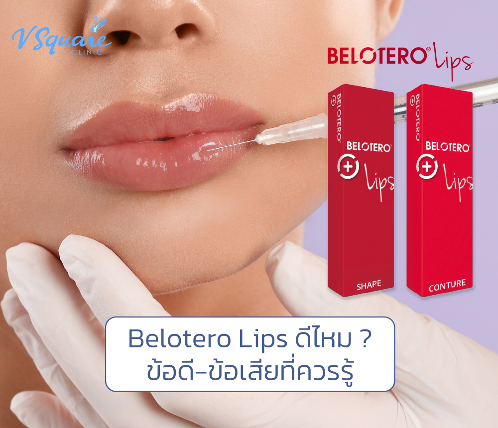 Belotero Lips(1)