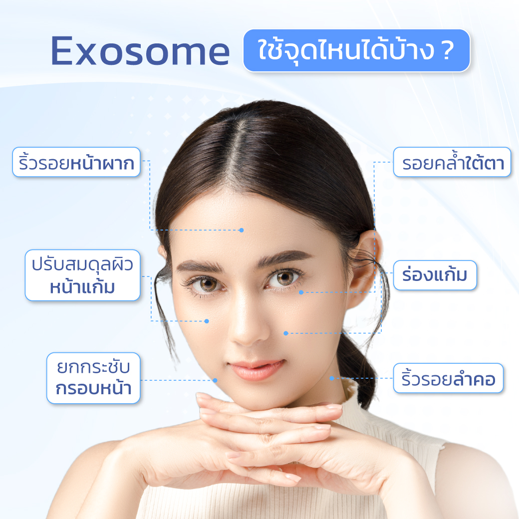 exosome ใช้จุดไหนได้บ้าง