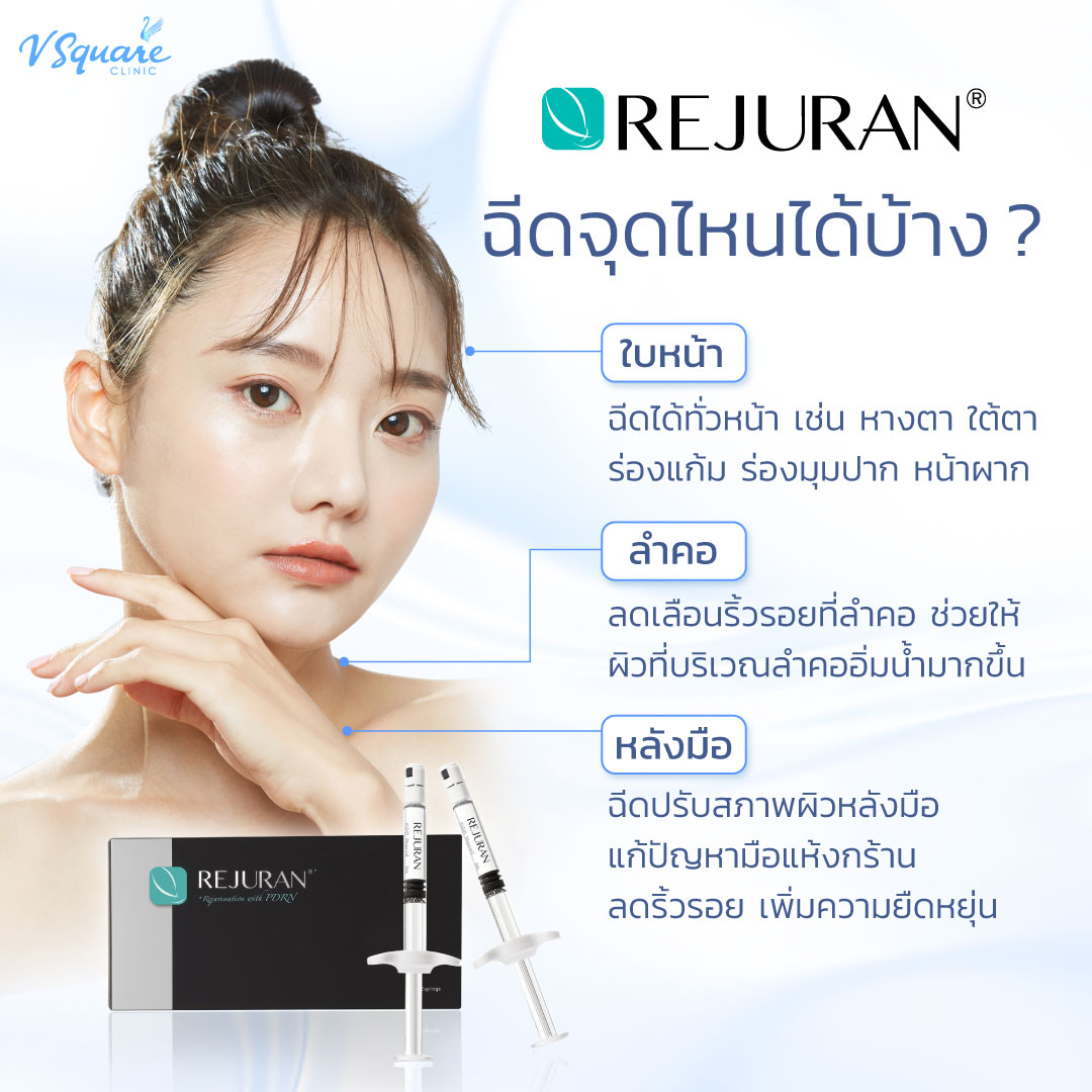 ฉีด Rejuran จุดไหนได้บ้าง