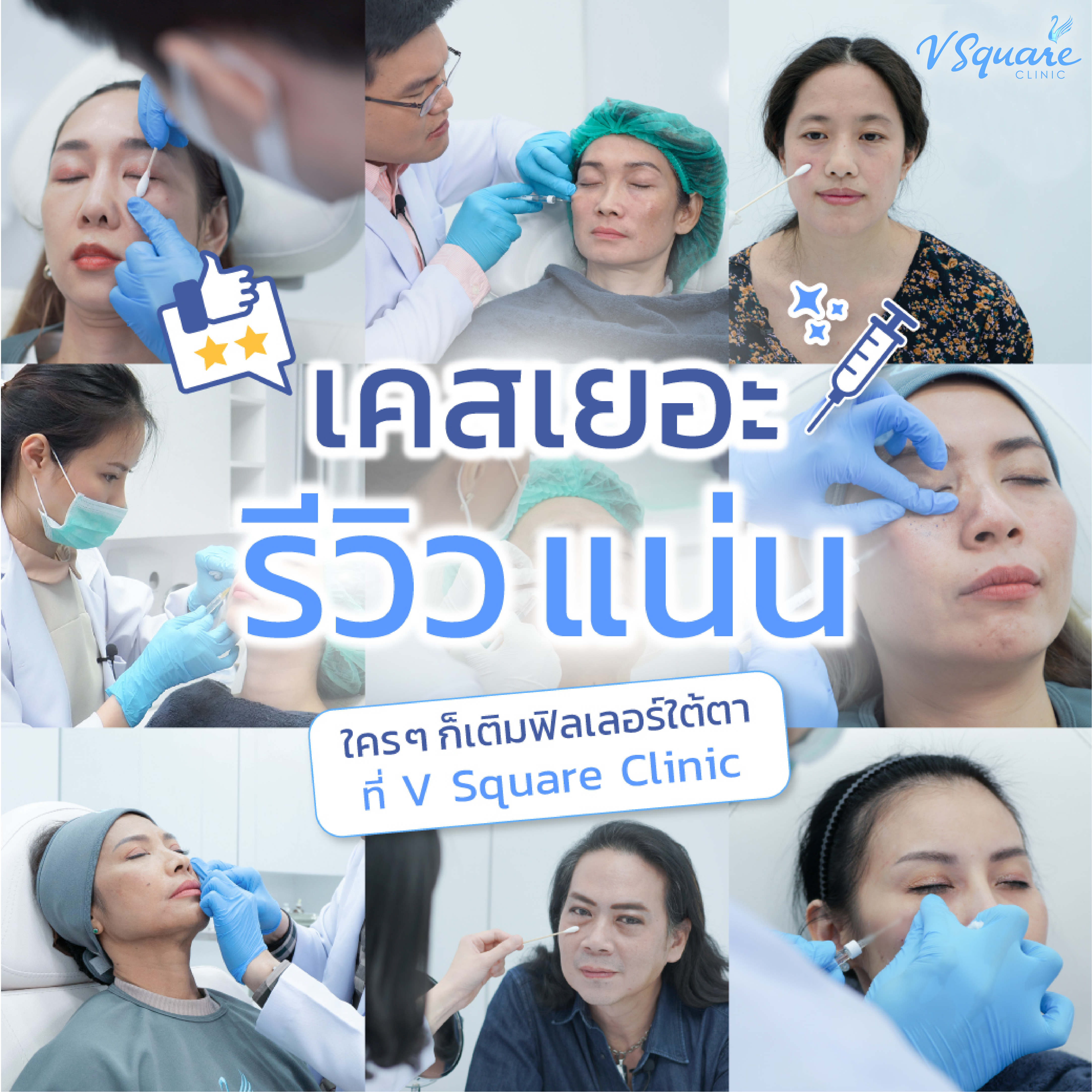 รีวิวฉีดฟิลเลอร์ใต้ตาที่ V Square Clinic