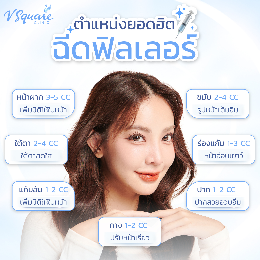 จุดฉีดฟิลเลอร์