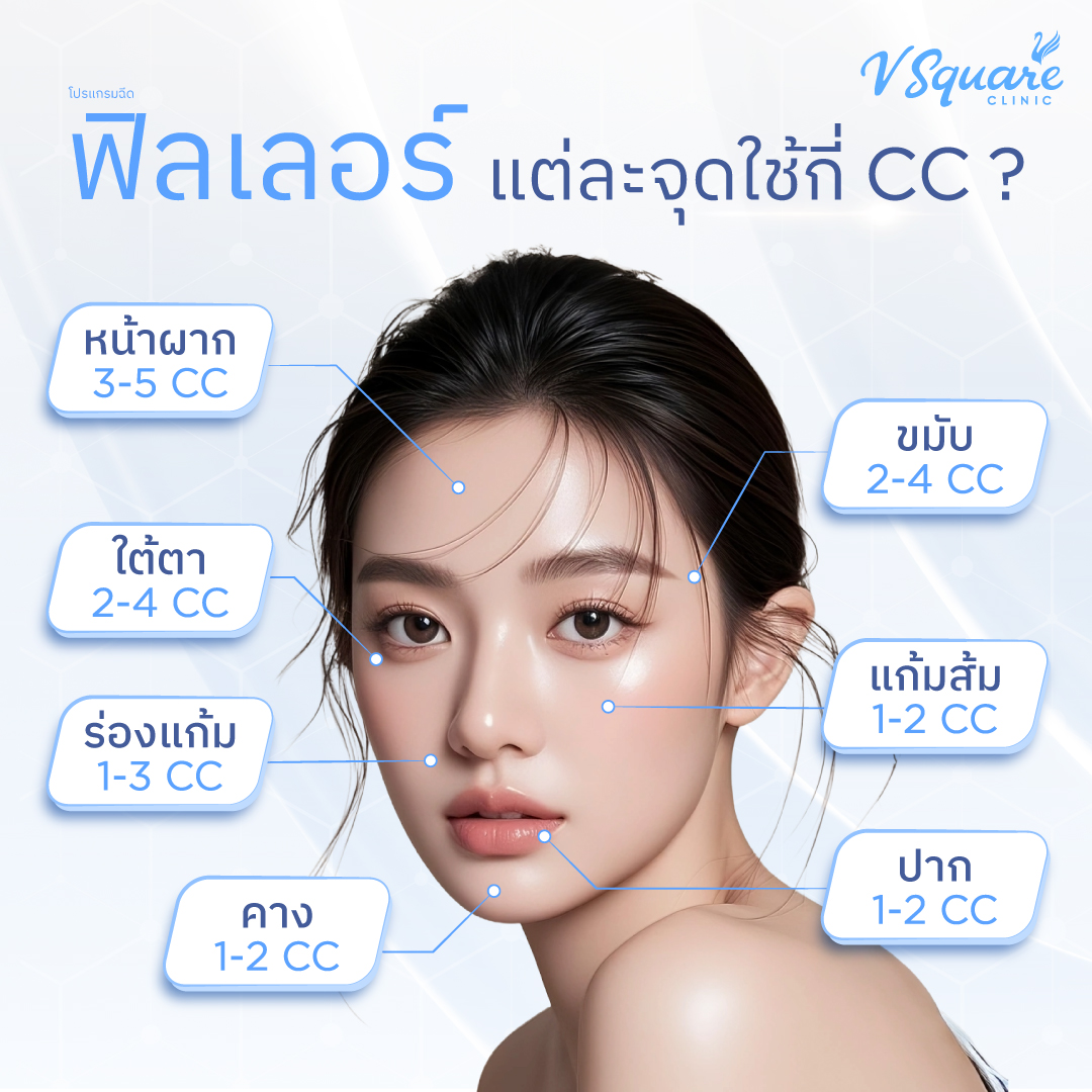 ฉีดฟิลเลอร์แต่ละจุดใช้กี่ CC