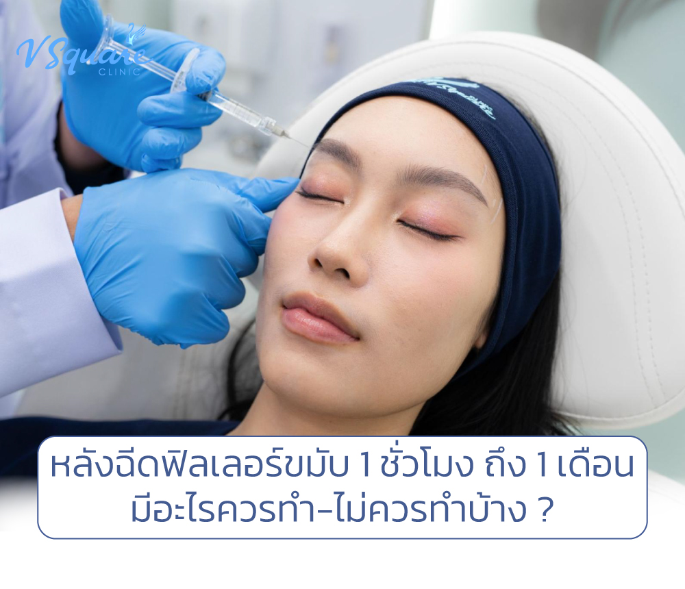 หลังฉีดฟิลเลอร์ขมับ