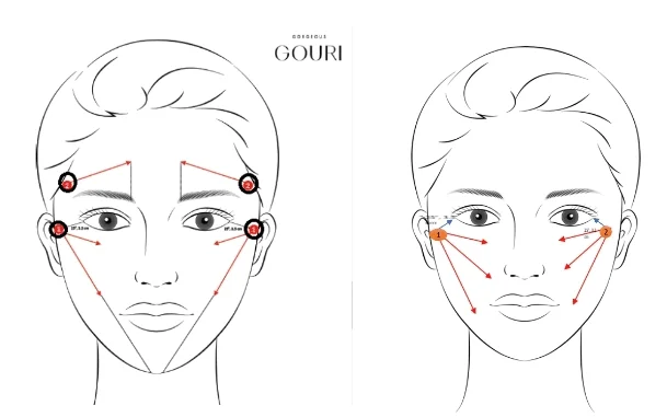 ตำแหน่งฉีด Gouri