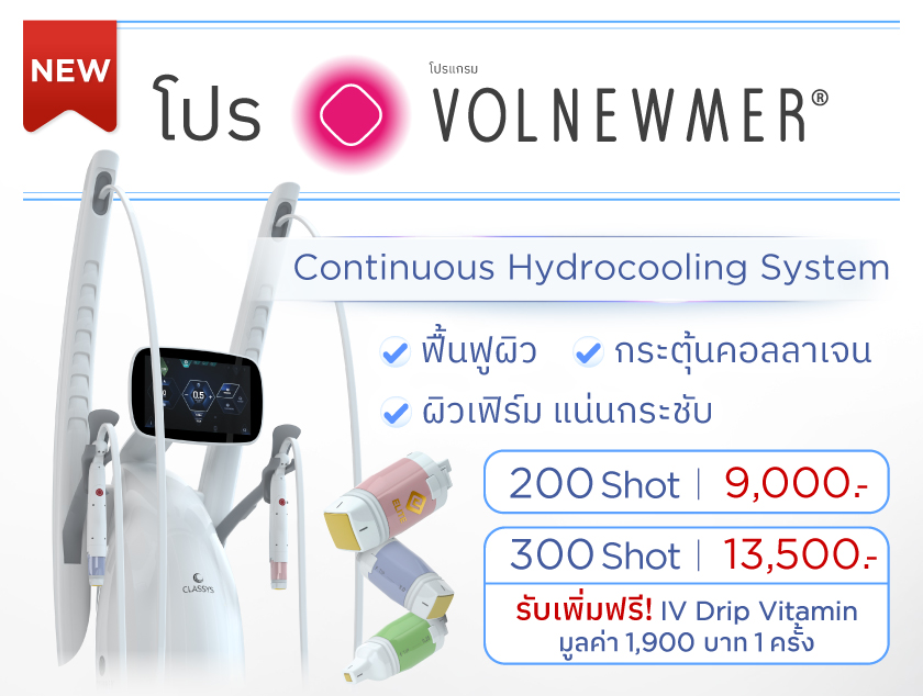Volnewmer ราคา
