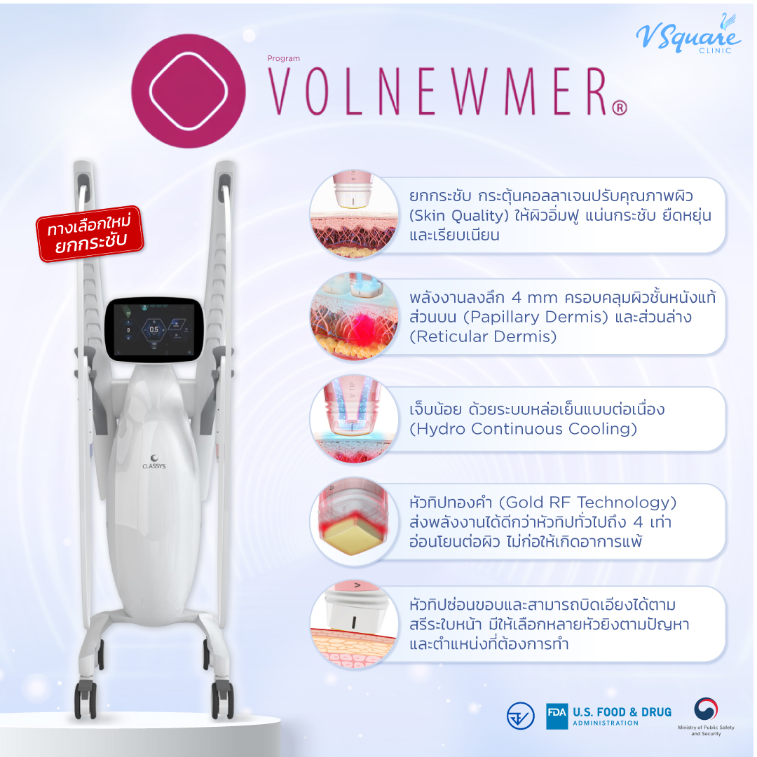 จุดเด่น ข้อดี volnewmer