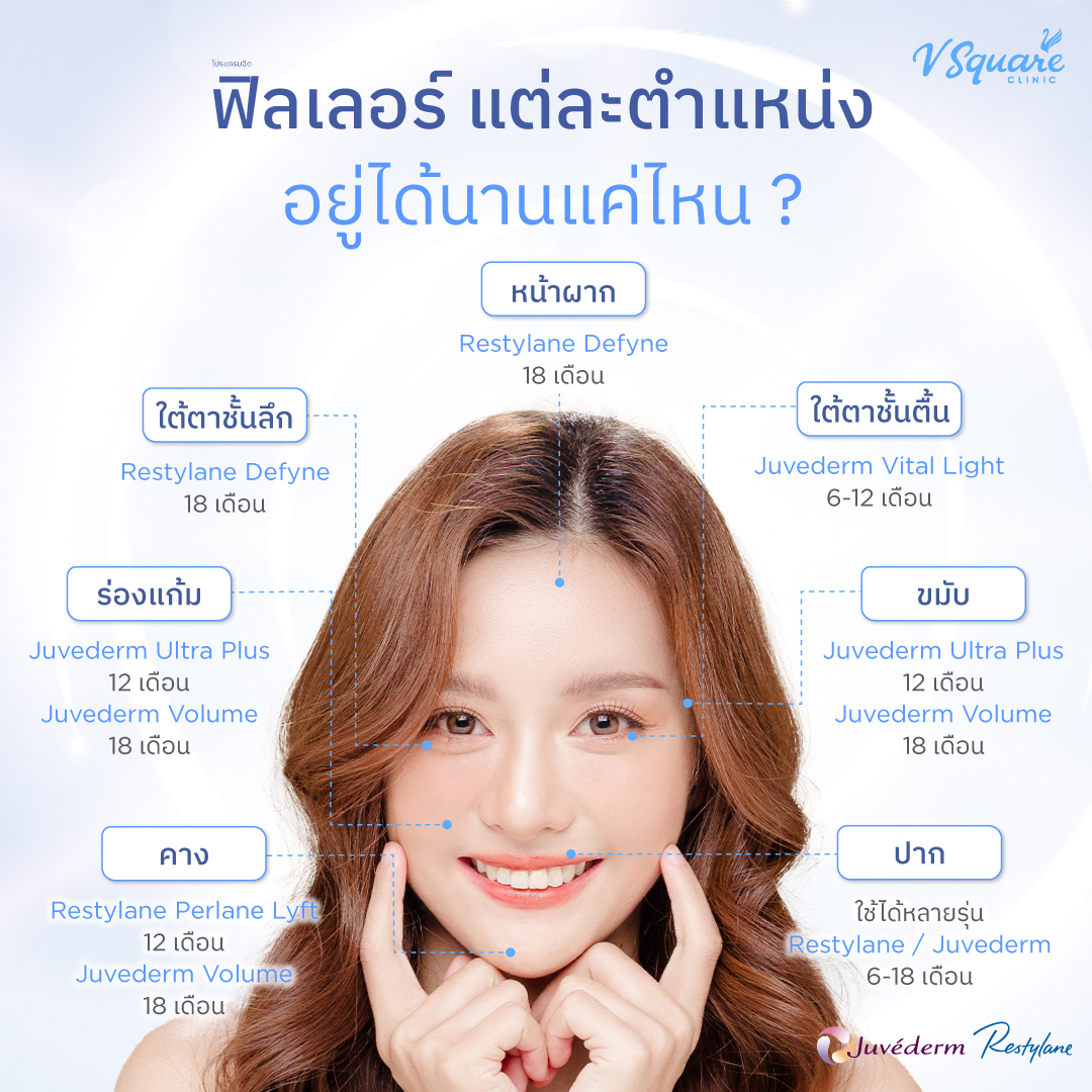 ฟิลเลอร์อยู่ได้นานกี่เดือน