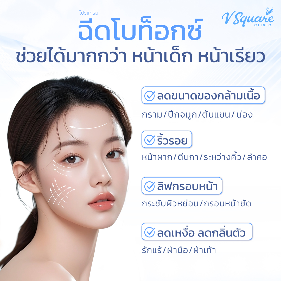 จุดฉีดโบท็อกซ์