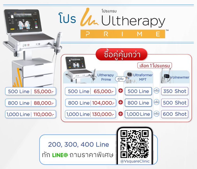 โปรโมชั่น Ultherapy-prime