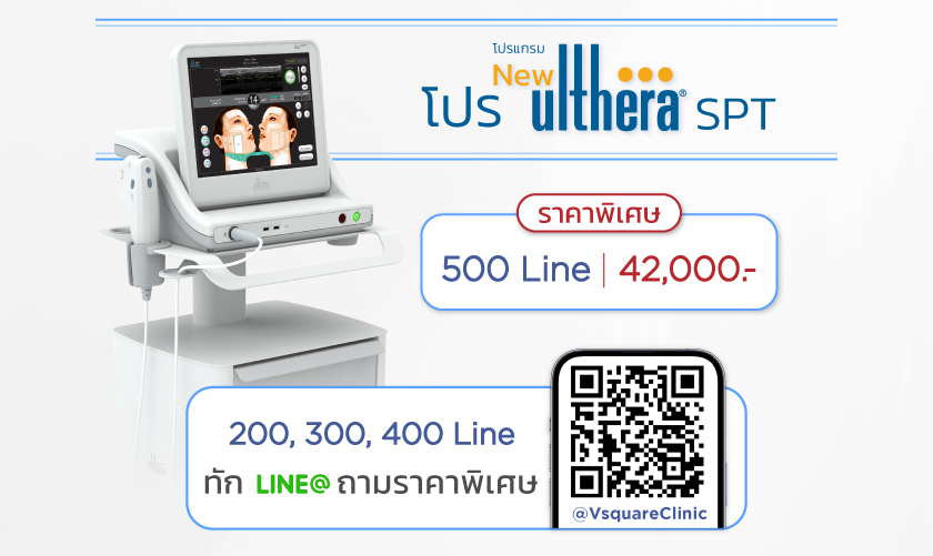 โปรโมชั่น SPT