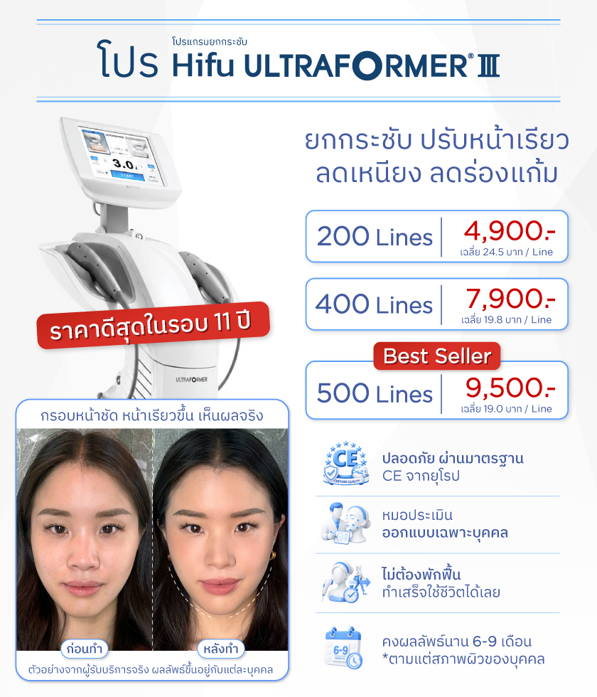 โปรโมชั่น Hifu