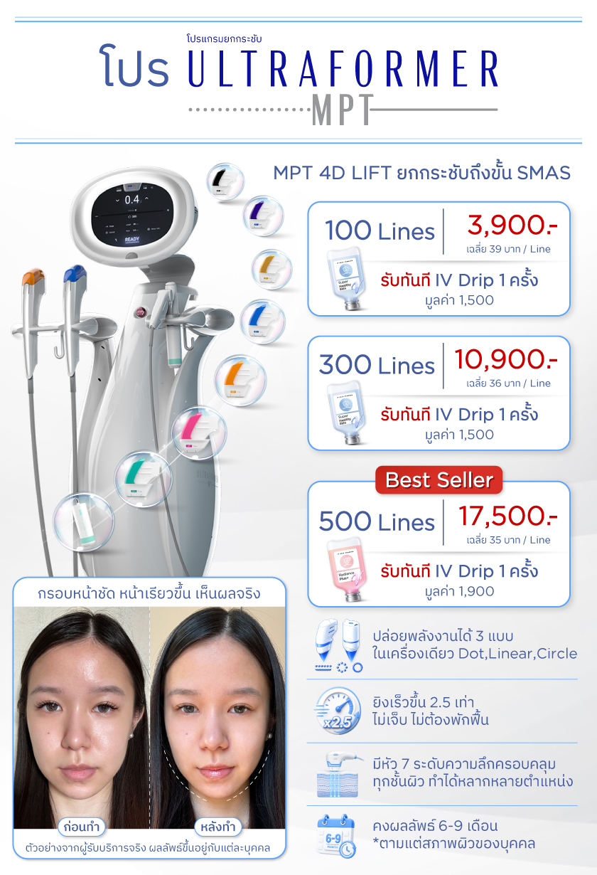โปรโมชั่น Ultraformer