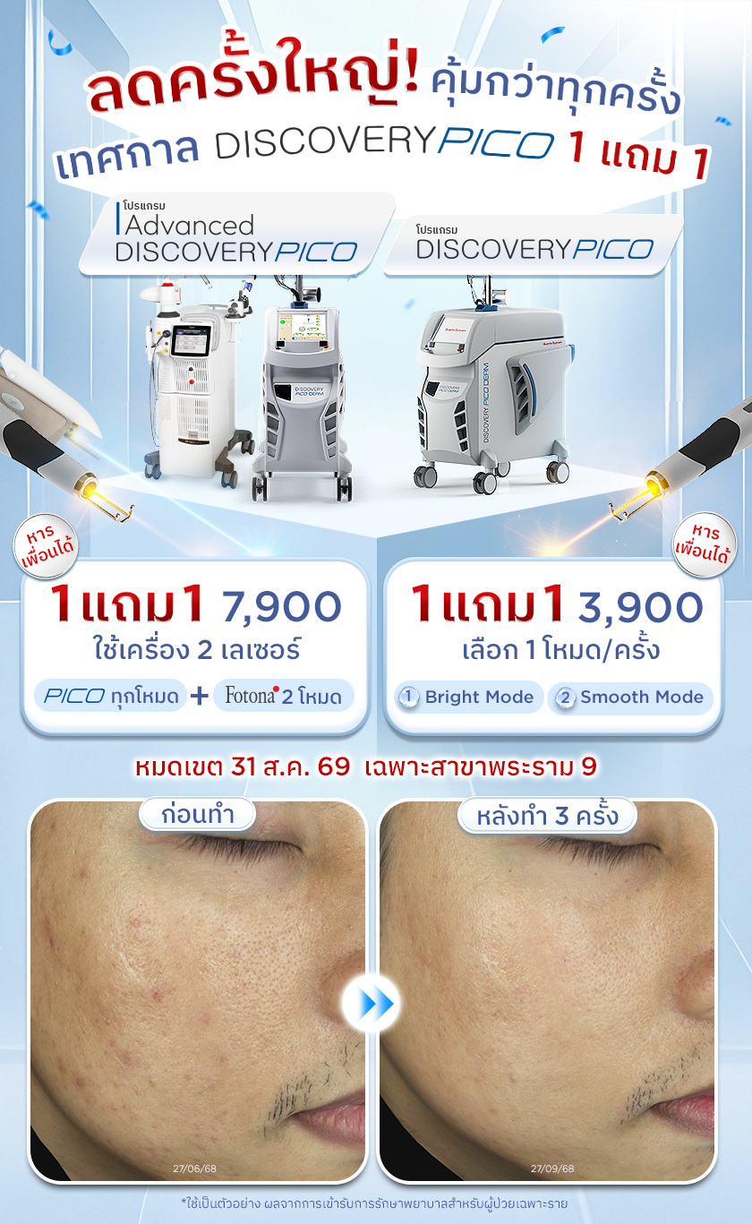 โปรโมชัน-PICO