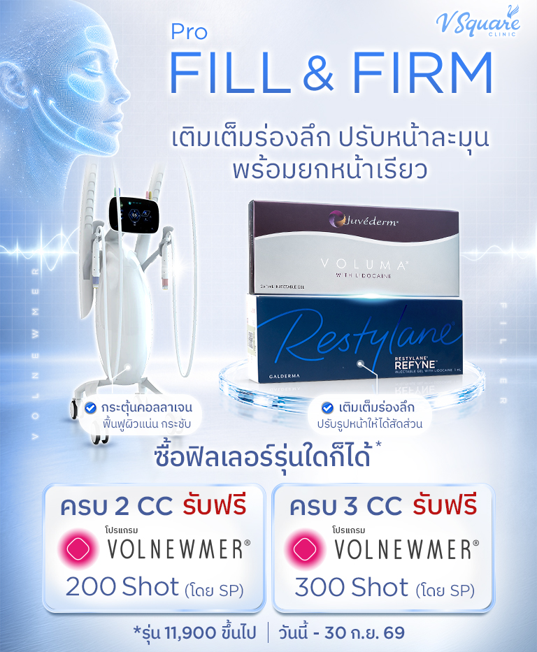 โปรฟิลเลอร์