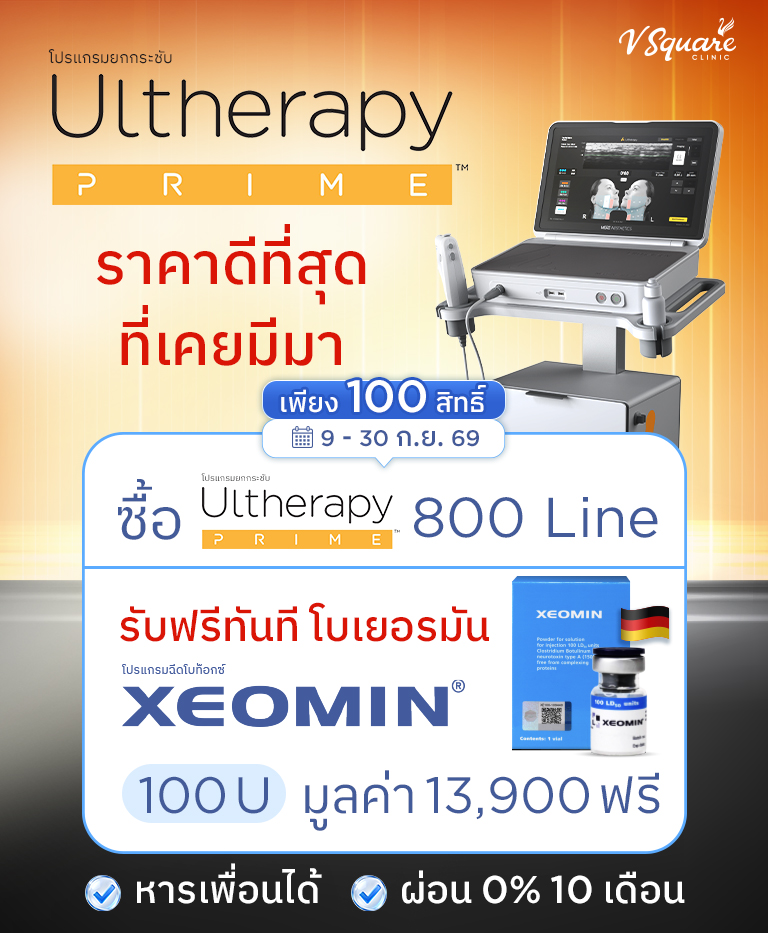 Ultherapy-prime