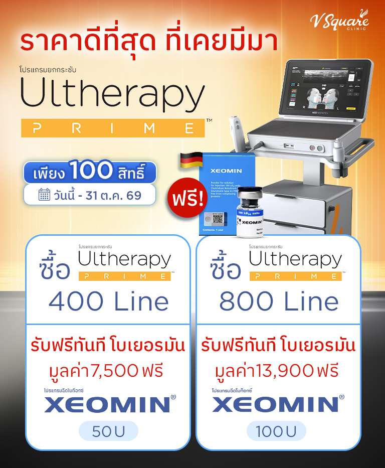 โปร Beyond Lift
